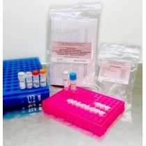 Тест-система для выявления норовирусов II геногруппы методом ПЦР с гибридизационно-флюоресцентной детекцией продуктов реакции «НоВ II-ПЦР»