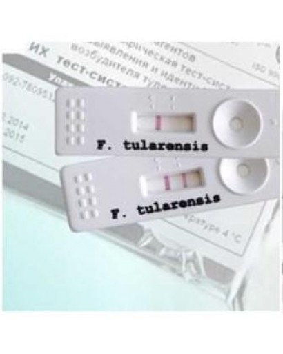 Набор реагентов для иммунохроматографического экспресс-выявления и идентификации возбудителя туляремии  «ИХ тест F.tularensis» 3 теста.
